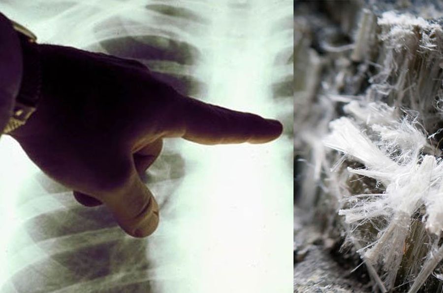 El Panorama de la Prohibición del Asbesto en Colombia